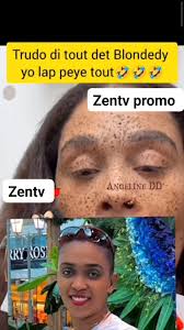 Blondedy di Kettia li pa dwel kob