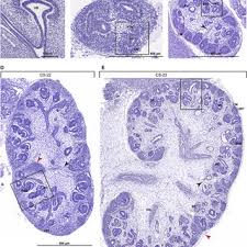 PDF) Conserved and Divergent Features of Human and Mouse Kidney  Organogenesis