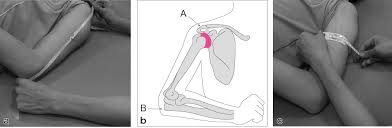 スポンサーリンク このページで学べる項目 1．身長・体重・bmiなど ・ 身長（bh：body height） ・ 体重（bw：body weight） 現体重（abw：actual body weight） actu… 続きを読む »身体計測値と計算式（身長・体重から上腕周囲長・上腕三頭筋皮下脂肪厚・上腕筋囲など） 4 ä¸Šè…•å'¨å›²é•· Ac Arm Circumference ãƒ‹ãƒ¥ãƒ¼ãƒˆãƒªãƒ¼æ ªå¼ä¼šç¤¾
