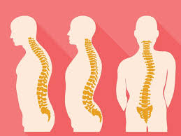 Terjadi karena sekresi yang berkurang dariglukokortikoid. 5 Kelainan Tulang Yang Paling Sering Terjadi Bukan Cuma Osteoporosis Good Doctor Tips Kesehatan Chat Dokter Beli Obat Online