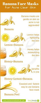 Banana Masks Acne Infographic Homemade Acne Treatment Banana Face Mask Acne Face Mask