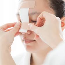 Medicines and staying away from allergens may help decrease your symptoms. Symptoms Of Nasal Valve Collapse