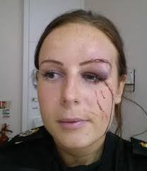 Cops left with fractured skulls and gouged eyes after being battered