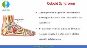 Image result for Cuboid