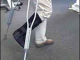 25 Weight Bearing Demo Brbj Foot Ankle Youtube