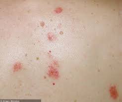 We did not find results for: Lupus Erythematodes Selbsthilfegruppe Darmstadt