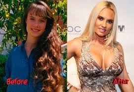 Coco Austin Plastic Surgery Before And After Coco Austin Plastic Surgery Celebrity Plastic Surgery