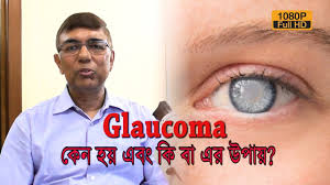 Joe's mum suffered from glaucoma. à¦š à¦– Glaucoma à¦• à¦¨ à¦¹à¦¯ à¦à¦¬ à¦• à¦¬ à¦à¦° à¦‰à¦ª à¦¯ Advise By Eye Specialist Dr Subhashis Das Ep 303 Youtube