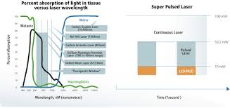 Super Pulsed Laser Technology Explained Superpulsed