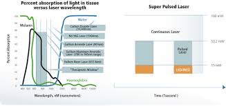 super pulsed laser technology explained superpulsed