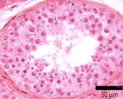 We did not find results for: Male Reproductive The Histology Guide