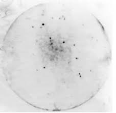 Since cdna libraries lack introns and other nontranscribed sequences, they are smaller and easier to use than genomic libraries, but they don't contain as much regulatory information. Construction And Screening Of A Cdna Library From The Triactinomyxon Spores Of Myxobolus Cerebralis The Causative Agent Of Salmonid Whirling Diseases Parasitology Cambridge Core