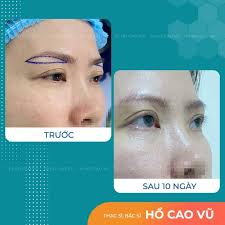 Nâng cung mày bao lâu thì xăm được? Tiết lộ thú vị khiến bạn ngỡ ngàng