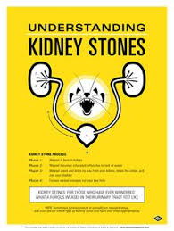 So he brings a glass of 1970 wine to the customer. Kidney Stone Banter