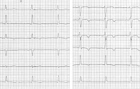 Journal of the american college of cardiology vol. Https Www Thieme Connect De Products Ebooks Pdf 10 1055 B 0034 44791 Pdf