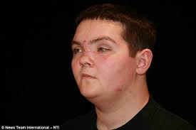 Steven Thorpe: Teenager declared brain-dead by FOUR doctors makes miracle  recovery