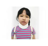 China OEM Paediatric Soft Neck Brace Orthopedic Cervical ...