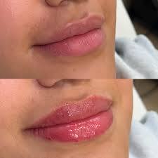 Kayla Rucker, BSN, RN (@kaylarucker.rn) • Instagram photos and videos