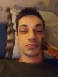 Dash update! No more bandage changes needed