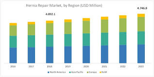 Hernia mesh devices market is driven by increase in surgical procedures, improvement in reimbursement scenario, presence of enhanced health key companies operating in the global hernia mesh devices market are medtronic plc, becton, dickinson and company, johnson & johnson. Hernia Repair Market By Product Type Geography Covid 19 Impact Analysis Marketsandmarkets