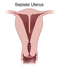 It's unusual for endometrial tissue to spread beyond your pelvic region, but it's not impossible. What You Should Know About Uterine Anomalies Dr Seckin
