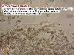 From A To Z In Complete Urine Analysis Urinalysis Part Two Page 10 Medicine Science And More