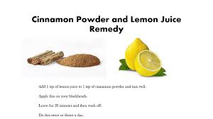 Remedy For Blackheads By Salon Khaleesi Kalpani R Youtube youtube