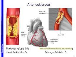 Insulin Biologische Physiologische Und Medizinische Grundlagen Diabetes Mellitus
