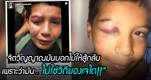 เด็กชายถูกรุมบูลลี่ แต่เขาปฏิเสธที่จะสู้กลับ โดยให้เหตุผลว่า  “มันไม่ใช่วิถีของเจได”