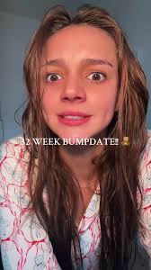 Gender Reveal: It's a Girl! 🎉