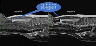 脊柱畸形 脊髓脊膜膨出 脊髓栓系 腰间盘突出 脊髓脊柱肿瘤 颈椎病 椎管狭窄 小脑扁桃体下疝 脊髓空洞症 强直性脊柱炎 脊髓脊椎损伤 腰骶皮毛窦 脊髓. è„Šé«„ç©ºæ´žç—‡ æ•´å½¢å¤–ç§' ã¿ãªã¿é‡Žå‹•ç‰©ç—…é™¢ å…«çŽ‹å­ã¿ãªã¿é‡Ž