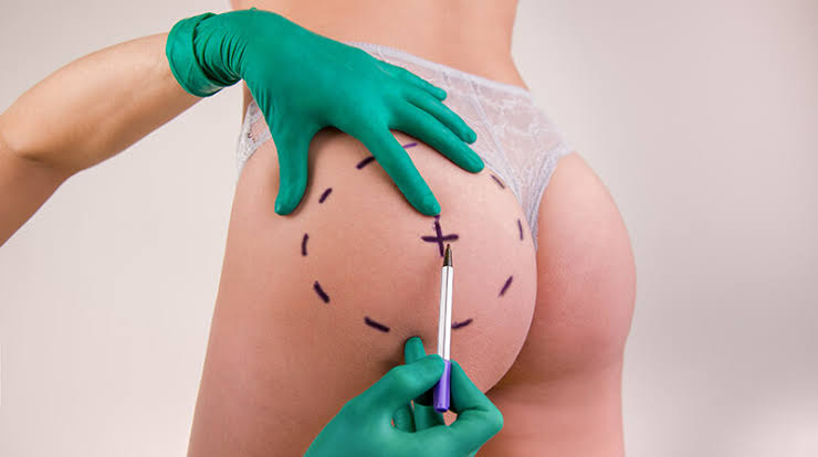 Body Fillers for Natural-Looking Results