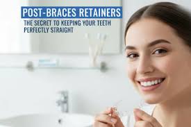 Post Braces Retainer: Keep Teeth Perfectly Straight