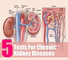 Pin On Urinary