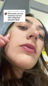 Con Esa Skin Cualquiera Que Significa