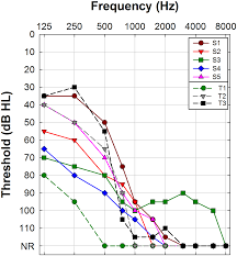 in vivo electrocochleography in hybrid cochlear implant