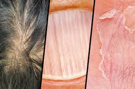 Protein Deficiency 7 Signs You Re Not Getting Enough Protein