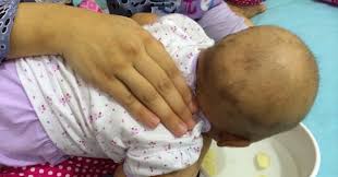 Cara yang terakhir adalah dengan menaruhnya di dalam toples yang tertutup. Hamil Bersalin Menyusu Teknik Hilangkan Kahak Bayi