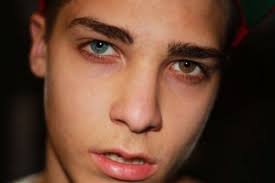 Heaven One Blue One Green Brown Hazel Heterochromia Dark Eyes Heterochromia Iridum