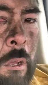 To stare one out of countenance. The Story Behind One Firefighter S Thousand Yard Stare Videos From The Weather Channel Weather Com