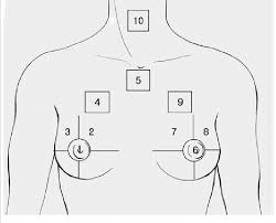 Right superficial lymphatic vessels of chest. Schematic Of 10 Skin Flap Zones On The Anterior Chest Area Of A Download Scientific Diagram