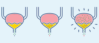 Urinary Tract Infections And Cycling What You Need To Know Velo Me