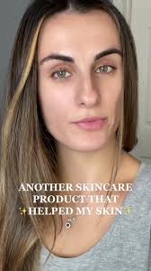 Effaclar Duo Acne Treatment Review