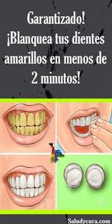 8 Ideas De Eliminar Sarro Dientes Eliminar Sarro Dientes Eliminar Sarro Blanqueamiento Dental Casero