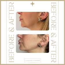 Dr Louise Pierre Aesthetics, Peacehaven