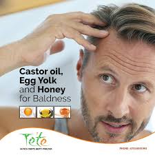 Getting enough vitamin e helps keep your scalp healthy, and a healthy scalp promotes hair growth. Tete Gents Beauty Parlour Castor Oil Egg Yolk And Honey For Baldness Take 1 Tablespoon Of Castor Oil Mix The Oil With 2 Eggs Yolk Add 1 Tablespoon Honey In It