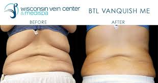 Pin On Treatments We Love