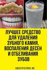 отбеливание зубов в домашних условиях без вреда для эмали Luchshee Sredstvo Dlya Udaleniya Zubnogo Kamnya I Otbelivaniya Zubov Otbelivanie Zubov Domashnee Lechenie Zuby