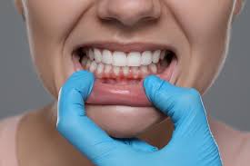 Unveiling the Secrets to a Radiant Smile: Essential Tips for Maintaining  Healthy Gums and Teeth - Riverside Dental