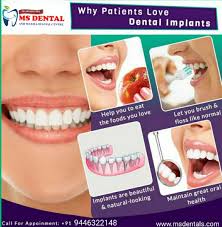 Dental Implant In 2020 Dental Implants Best Dental Implants Dental